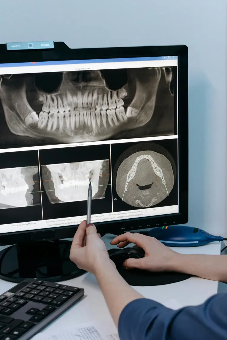 Tomografía Cone Beam 3D dental