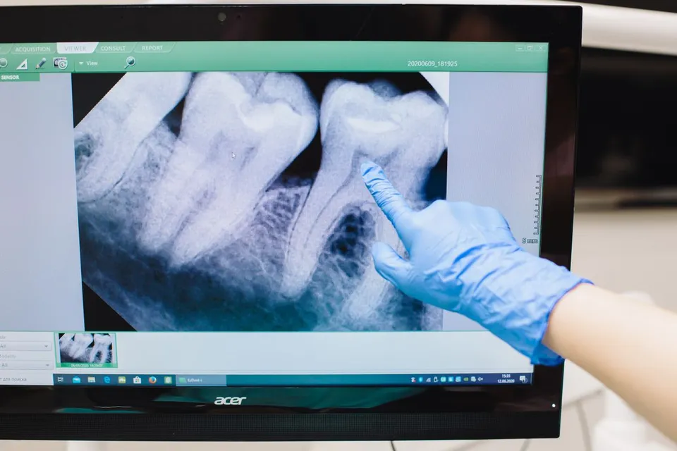Periapical